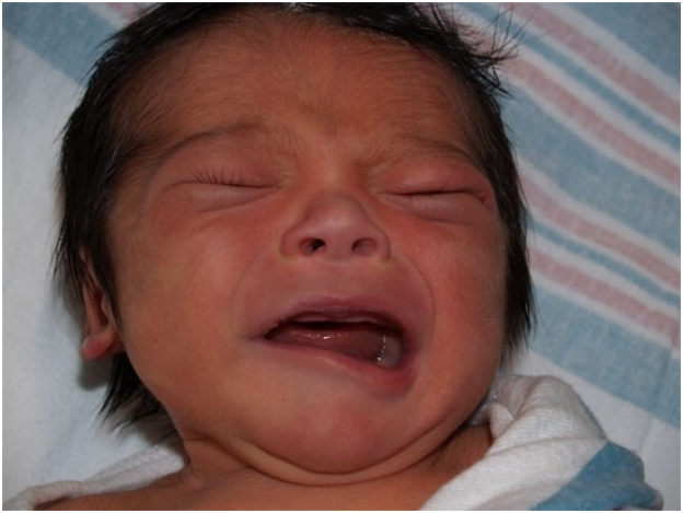 7 Common Birth Injuries Parents Need To Know!